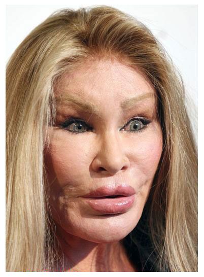 CelebrityPlasticSurgeryGoneWrong_zps73ed9c6e.jpg